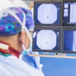 pemasangan stent jantung