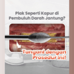 Solusi untuk Plak Kalsifikasi