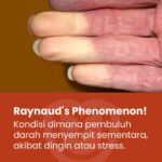 Jari Tangan Pucat dan Dingin? Kenali Fenomena Raynaud dan Kapan Harus Waspada