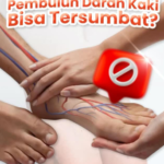 Kaki Sering Pegal? Waspada Peripheral Artery Disease (PAD) dan Kenali Solusi Angioplasti