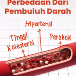 Awas Penyumbatan Pembuluh Darah: Kenali 3 Faktor Risiko Utama dan Mekanismenya