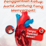 Mengenal Stenosis Aorta dan TAVR: Solusi Penggantian Katup Jantung Tanpa Operasi Terbuka