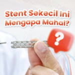Rahasia di Balik Harga Stent Jantung: Kecil Ukurannya, Besar Peranannya