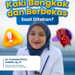 Kaki Bengkak Tak Kunjung Kempes? Kenali Pitting Edema Sebagai Sinyal Sembunyi Gagal Jantung