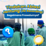 Mengatasi Jantung Berdebar: Mengenal Ablasi Jantung Sebagai Terapi Tanpa Operasi Terbuka