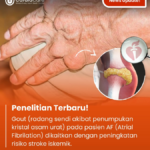 Bahaya Ganda: Mengapa Penderita Atrial Fibrillation dengan Gout Berisiko Tinggi Terkena Stroke Iskemik?