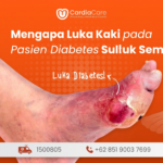 Mengapa Luka Kaki pada Pasien Diabetes Sulit Sembuh? Waspadai PAD!