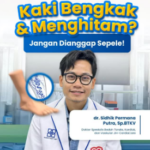 Kaki Bengkak dan Menghitam? Waspadai Bahaya Chronic Venous Insufficiency (CVI)