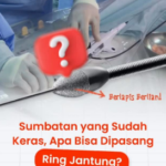 Fakta Pemasangan Ring Jantung: Solusi Tepat Menangani Sumbatan Keras dengan Teknologi Rotablator