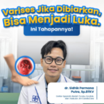 Mengenal 6 Stadium Varises: Jangan Anggap Remeh, Kenali Bahaya dan Cara Penanganannya