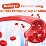 Mengenal Kelainan Pembuluh Darah: Aterosklerosis, Aneurisma, dan Diseksi Aorta