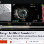 IVUS (Intravascular Ultrasound): Teknologi Pencitraan Canggih untuk Optimalisasi Pemasangan Ring Jantung