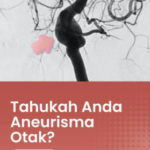 Aneurisma Otak: Mengenal Bahaya “Silent Killer”, Diagnosis DSA, dan Prosedur Penanganannya