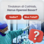 Apa Itu Ruang Cathlab? Mengenal Prosedur Minimal Invasif untuk Penyakit Jantung dan Pembuluh Darah