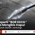Mengenal Rotablator: Teknologi Rotational Atherectomy untuk Mengatasi Pengapuran Koroner Berat