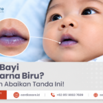 Memahami Penyakit Jantung Bawaan (PJB) dan Gejala Sianosis (Bibir Kebiruan) pada Bayi