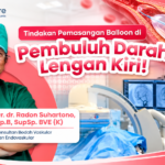 Penanganan Sumbatan Akses Pembuluh Darah Cimino (AV Shunt) dengan Metode Balloon Angioplasty
