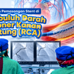 Evaluasi Tindakan Pemasangan Stent (Ring) pada Pembuluh Darah Koroner Kanan (RCA)