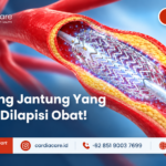 Ternyata Ring Jantung Ada yang Dilapisi Obat: Memahami Drug-Eluting Stent (DES) dan Terapi Antiplatelet