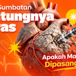 Penanganan Sumbatan Pembuluh Darah Keras: Teknik Modifikasi Kalsium Sebelum Pemasangan Stent